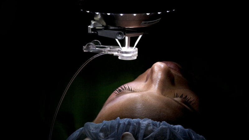 LASIK skin plastic surgery
